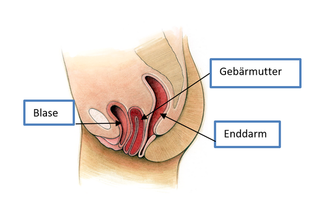 Vorfall von Gebärmutter, Blase und Enddarm